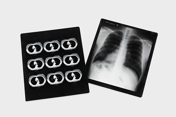 Thermal film